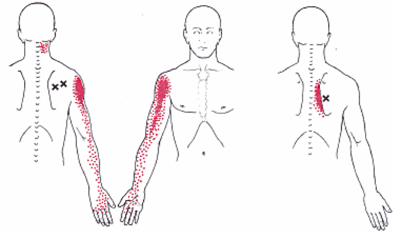 SHOULDER PAIN - ATX Orthopedics